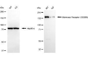 Western blotting analysis using mannose receptor (CD206) antibody (ABIN7799329). (Recombinant Mannose Receptor 抗体)