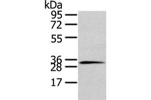 Gel: 10 % SDS-PAGE, Lysate: 80 μg, Lane: 231 cell, Primary antibody: ABIN7128026(STX19 Antibody) at dilution 1/800 dilution, Secondary antibody: Goat anti rabbit IgG at 1/8000 dilution, Exposure time: 10 seconds (Syntaxin 19 抗体)