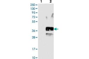 Western blot analysis of Lane 1: Negative control (vector only transfected HEK293T lysate). (SLC10A2 抗体)
