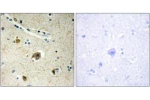 Immunohistochemistry analysis of paraffin-embedded human brain tissue, using Collagen IV alpha4 Antibody. (Col4a4 抗体  (AA 541-590))