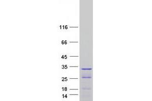Western Blotting (WB) image for Protein Phosphatase 1, Regulatory Subunit 12B (PPP1R12B) (Transcript Variant 4) protein (Myc-DYKDDDDK Tag) (ABIN2729470)