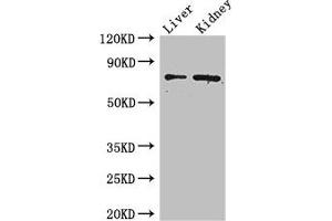 Western Blot Positive WB detected in: Mouse liver tissue, Mouse kidney tissue All lanes: ZFP64 antibody at 4 μg/mL Secondary Goat polyclonal to rabbit IgG at 1/50000 dilution Predicted band size: 75, 69, 73, 49, 47 kDa Observed band size: 75 kDa (ZFP64 抗体  (AA 70-342))
