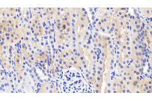 Detection of IL18 in Porcine Kidney Tissue using Polyclonal Antibody to Interleukin 18 (IL18) (IL-18 抗体  (AA 36-192))