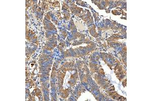 IHC analysis of SNPH using anti-SNPH antibody (ABIN7601724). (Syntaphilin 抗体  (AA 43-482))