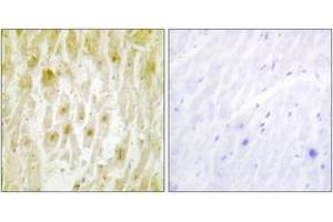 Immunohistochemistry analysis of paraffin-embedded human heart tissue, using TF2E2 Antibody. (GTF2E2 抗体  (AA 151-200))