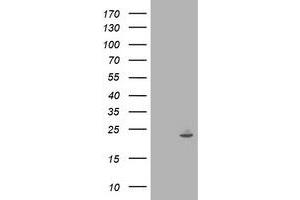 Western Blotting (WB) image for anti-Interferon-Induced Protein 35 (IFI35) antibody (ABIN1498799) (IFI35 抗体)