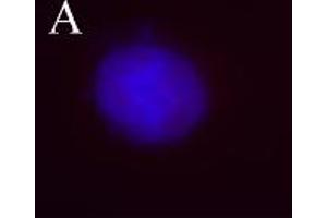 Image no. 3 for anti-Aurora Kinase B (AURKB) (pThr232) antibody (ABIN230502) (Aurora Kinase B 抗体  (pThr232))