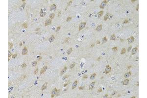 Immunohistochemistry of paraffin-embedded mouse brain using  Antibody (ABIN3022786, ABIN3022787, ABIN3022788 and ABIN6219229) at dilution of 1:100 (40x lens). (ADRBK2 抗体  (AA 1-300))