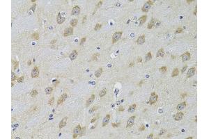 Immunohistochemistry of paraffin-embedded mouse brain using  Antibody (ABIN3022786, ABIN3022787, ABIN3022788 and ABIN6219229) at dilution of 1:100 (40x lens). (ADRBK2 抗体  (AA 1-300))