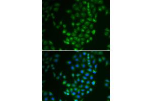 Immunofluorescence (IF) image for anti-Protein Kinase, CAMP Dependent, Catalytic, beta (PRKACB) antibody (ABIN1876512) (PRKACB 抗体)