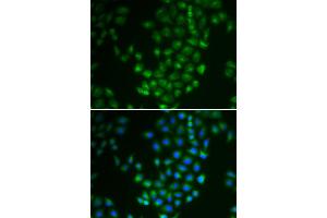 Immunofluorescence (IF) image for anti-Protein Kinase, CAMP Dependent, Catalytic, beta (PRKACB) antibody (ABIN1876512)
