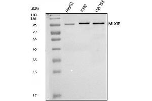 Western blot analysis of MLX-interacting protein/MLXIP using anti-MLX-interacting protein/MLXIP antibody (ABIN7602593).