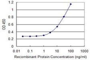 Detection limit for recombinant GST tagged SIK1 is 0. (SIK1 抗体  (AA 1-100))