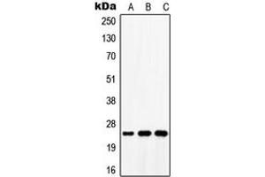 Western blot analysis of ATP5S expression in MCF7 (A), mouse lung (B), rat lung (C) whole cell lysates.