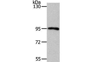 Western Blot analysis of Mouse kidney tissue using MYSM1 Polyclonal Antibody at dilution of 1:1100 (MYSM1 抗体)