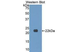 Western Blotting (WB) image for anti-Collagen, Type XVII (COL17) (AA 184-375) antibody (ABIN7434701)
