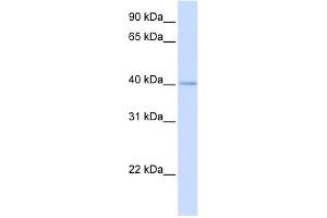 MRPL39 antibody used at 1 ug/ml to detect target protein. (MRPL39 抗体  (N-Term))