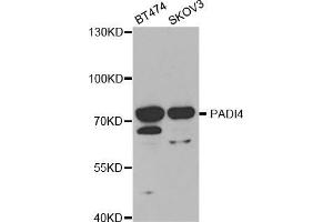 Western blot analysis of extracts of various cell lines, using PADI4 antibody (ABIN5970978) at 1/1000 dilution.