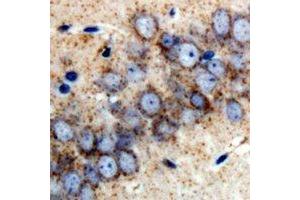 Immunohistochemistry (IHC) image for anti-Retinol Binding Protein 2, Cellular (RBP2) antibody (ABIN7308264) (RBP2 抗体)