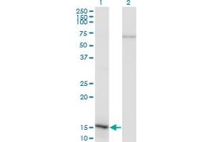 Western Blot analysis of NFATC2IP expression in transfected 293T cell line by NFATC2IP monoclonal antibody (M02), clone 3E9-B7. (NFATC2IP 抗体  (AA 1-138))