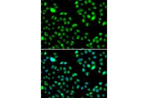 Immunofluorescence analysis of MCF7 cell using L3MBTL3 antibody. (L3MBTL3 抗体)