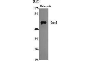 Western Blot (WB) analysis of specific cells using Dab1 Polyclonal Antibody. (DAB1 抗体  (Ser296))