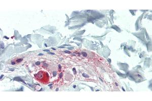 Immunohistochemistry of paraffin-embedded Colon, Submucosal Plexus tissue using TAC1 Polyclonal Antibody at dilution of 1:100. (TAC1 抗体)