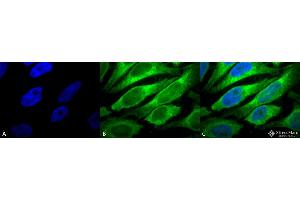 Immunocytochemistry/Immunofluorescence analysis using Mouse Anti-Erp57 (Grp58) Monoclonal Antibody, Clone Map. (PDIA3 抗体  (PerCP))