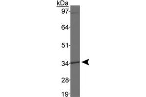Western blot analysis of DLX4 in MDA-MB-231 cell lysates using DLX4 polyclonal antibody . (DLX4 抗体  (AA 1-60))