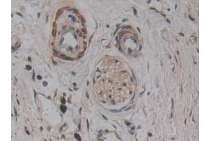 Immunohistochemistry (IHC) image for anti-Apoptosis-Associated tyrosine Kinase (AATK) (AA 1216-1374) antibody (ABIN7442786)