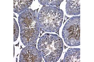IHC testing of FFPE mouse testis tissue with GSTM3 antibody at 1ug/ml. (GSTM3 抗体)