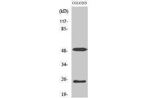 Western Blotting (WB) image for anti-Lecithin Retinol Acyltransferase (Phosphatidylcholine--Retinol O-Acyltransferase) (LRAT) (Internal Region) antibody (ABIN3185408) (LRAT 抗体  (Internal Region))