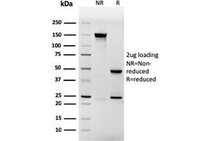 SDS-PAGE Analysis Purified Involucrin Mouse Recombinant Monoclonal Antibody (rIVRN/827). (Recombinant Involucrin 抗体)