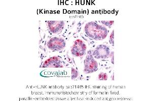 Image no. 1 for anti-Hormonally Up-Regulated Neu-Associated Kinase (HUNK) antibody (ABIN1735637) (HUNK 抗体)