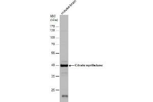 Western Blotting (WB) image for anti-Citrate Synthase (CS) antibody (ABIN2856769)