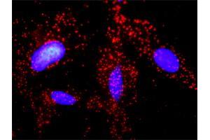 Proximity Ligation Analysis of protein-protein interactions between JUP and APC. (APC 抗体  (AA 2744-2843))
