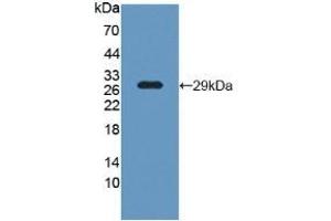 Detection of Recombinant LCP1, Human using Polyclonal Antibody to L-Plastin (LCP1) (LCP1 抗体  (AA 5-233))