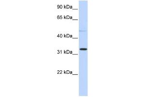 WB Suggested Anti-NEU4 Antibody Titration: 0. (Sialidase 4 抗体  (N-Term))