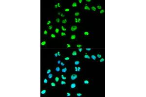 Immunofluorescence analysis of HeLa cell using MSH6 antibody. (MSH6 抗体  (AA 1-290))