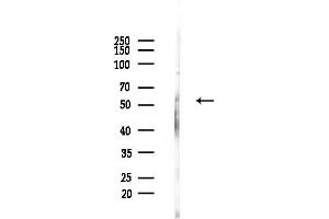 anti-Solute Carrier Family 13 Member 2 (SLC13A2) antibody