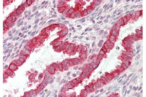 Rabbit Anti-KRT19 antibody  Formalin Fixed Paraffin Embedded Tissue: Human Uterus Primary antibody Concentration: 1:100 Secondary Antibody: Donkey anti-Rabbit-Cy3 Secondary Antibody Concentration: 1:200 Magnification: 20x Exposure Time: 0. (Cytokeratin 19 抗体  (N-Term))