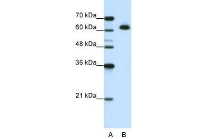 WB Suggested Anti-MGC42174 Antibody Titration:  1. (DIS3L2 抗体  (N-Term))