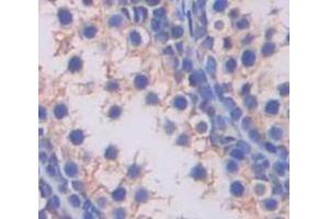 IHC-P analysis of Human Tissue, with DAB staining. (SLC2A14 抗体  (AA 51-105))
