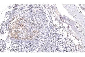 Immunohistochemistry (IHC) image for anti-Fc Fragment of IgE, Low Affinity II, Receptor For (CD23) (FCER2) (AA 151-321) antibody (ABIN7433819)