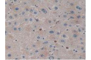 IHC-P analysis of Human Liver Tissue, with DAB staining. (Kallikrein 10 抗体  (AA 35-276))