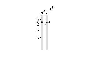 Western blot analysis of lysates from Hela cell line mouse spleen tissue lysate(from left to right), using TCF21 Antibody at 1:1000 at each lane.