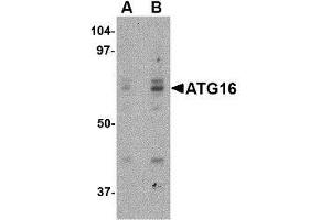 Western blot analysis of ATG16 in HeLa cell lysate with this product atG16 antibody at (A) 0. (ATG16L1 抗体  (Center))