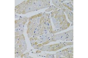 Immunohistochemistry of paraffin-embedded rat heart using GPD1 Antibody. (GPD1 抗体  (AA 1-349))