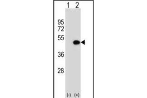 Western blot analysis of ILK (arrow) using rabbit polyclonal ILK Antibody (Center) 5884c.