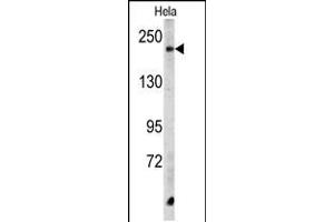 Western blot analysis of CPD Antibody in Hela cell line lysates (35ug/lane) (CPD 抗体  (C-Term))